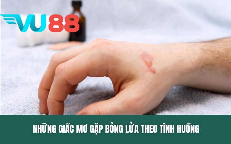 Những giấc mơ gặp bỏng lửa theo tình huống